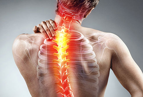 cervical spine pain and neck pain treatment by spine specialist in Ludhiana